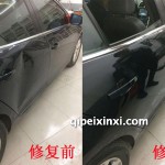 凹陷修復(fù)技術(shù)